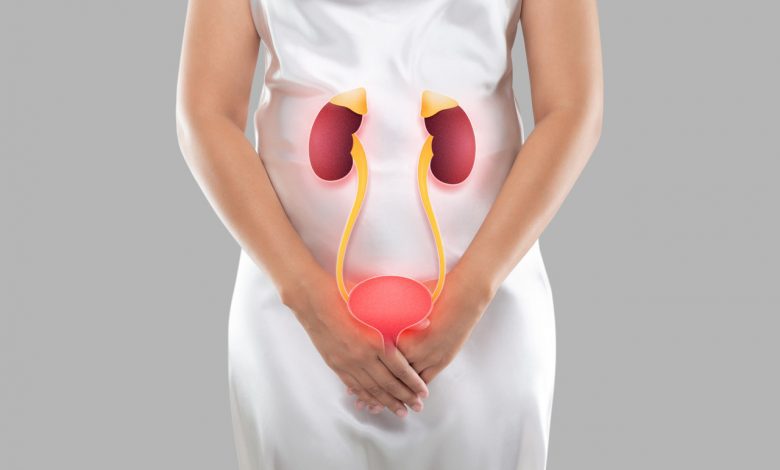Urologia Goiânia - Mulher pode ter câncer urológico
