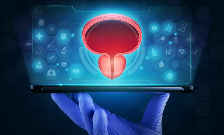 Qual a melhor opção de cirurgia a laser para próstatas de grande volume
