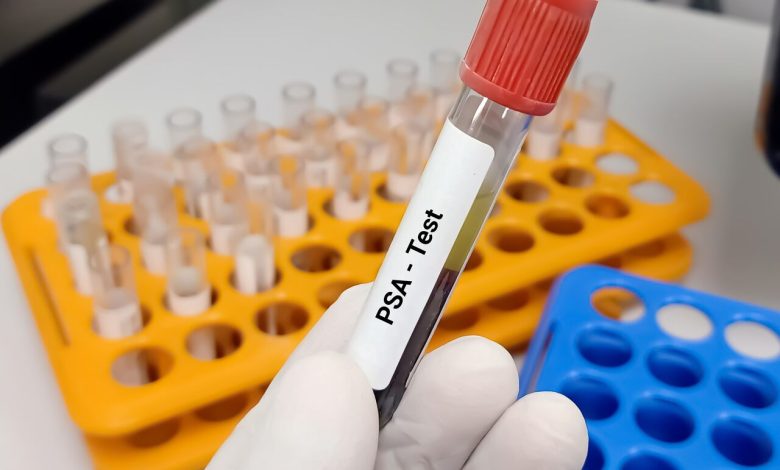 PSA alto está sempre relacionado ao câncer de próstata