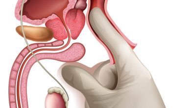 Exame de toque: porque este exame é essencial no diagnóstico precoce do câncer de próstata