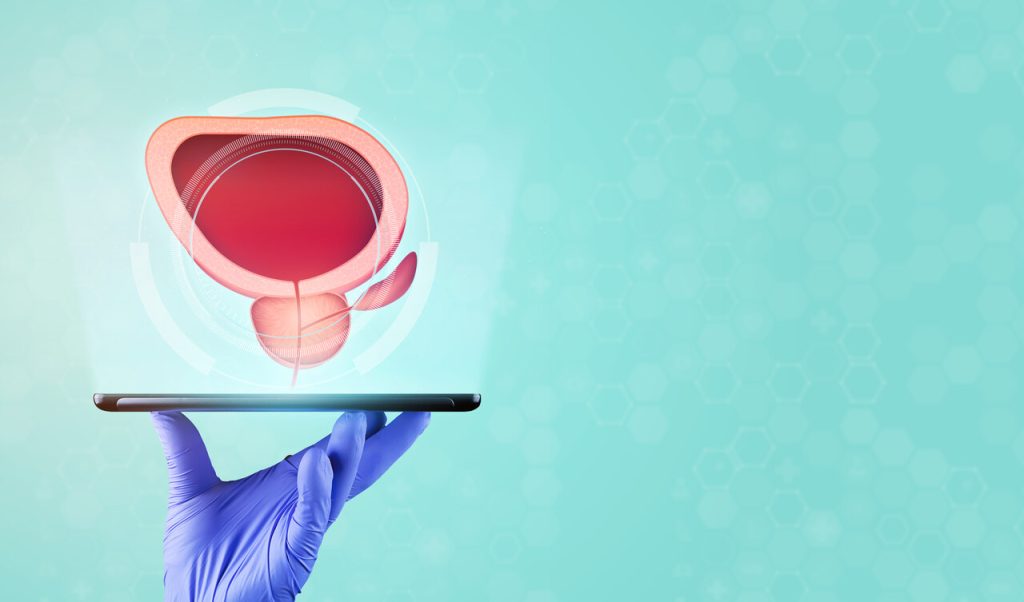 Está com a próstata aumentada Quando é necessário operar