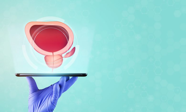 Está com a próstata aumentada Quando é necessário operar